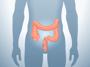 Colon diagram C. diff